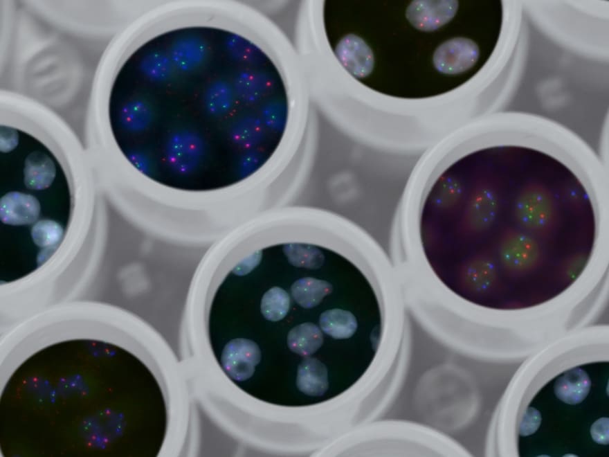 In this illustration, images of genes (red, green, and blue spots within the nuclei of HeLa cells) are artificially superimposed on images of multi-well plates.